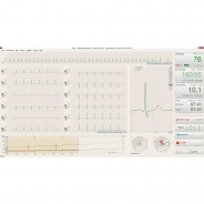 BTL CardioPoint-Ergo E300 - компьютеризированная стресс-тест система